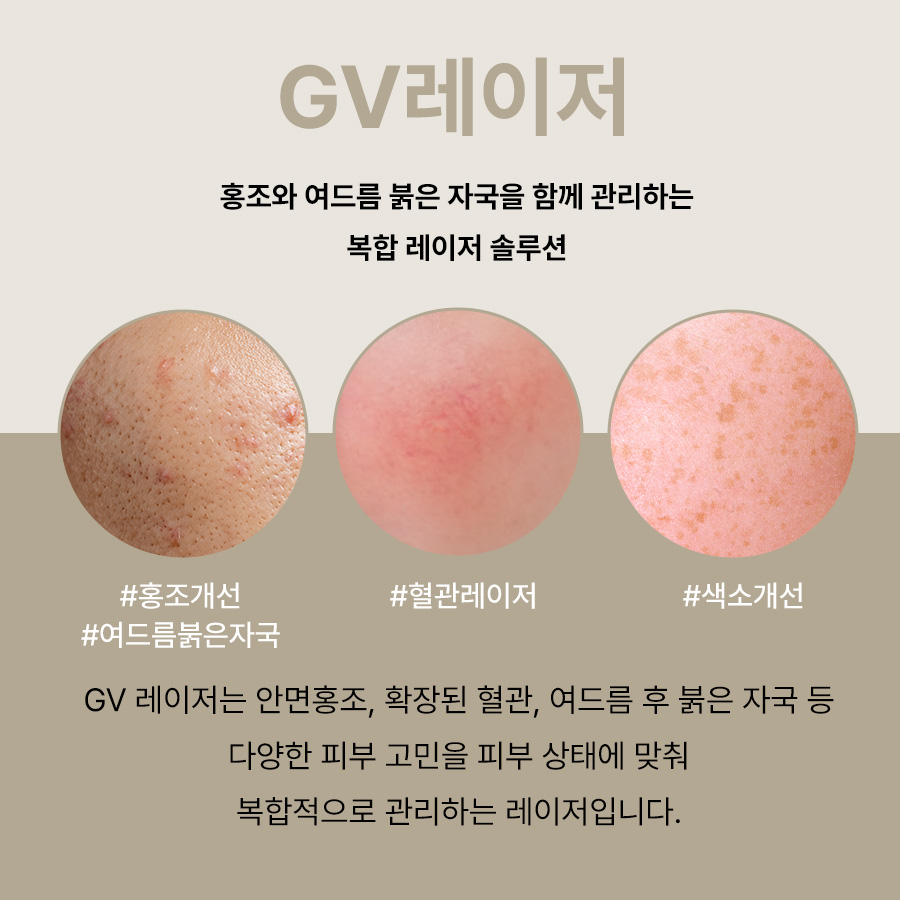 본문 내용을 보조하는 이미지
