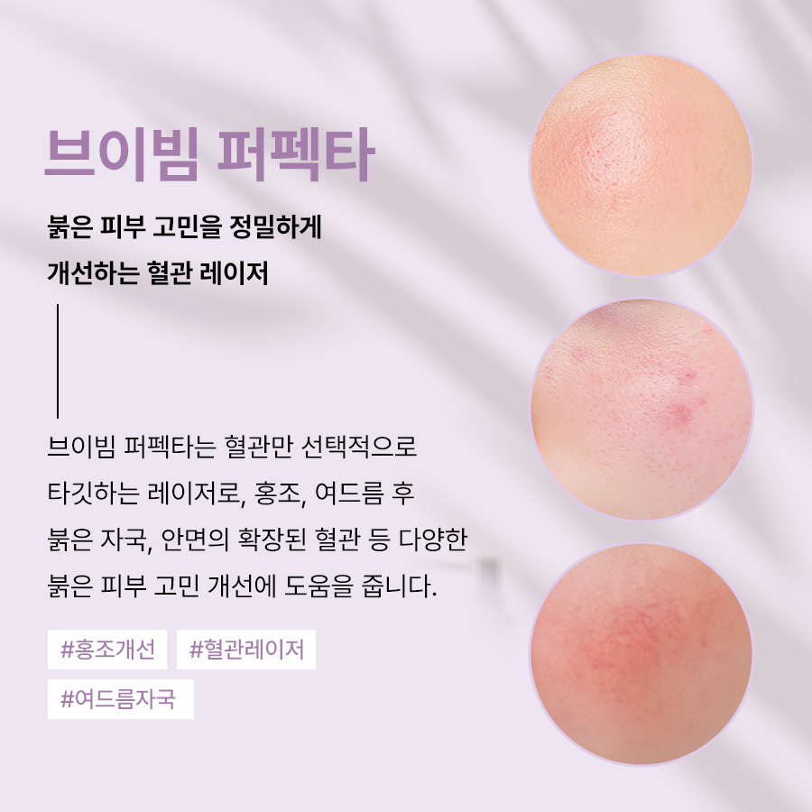 본문 내용을 보조하는 이미지
