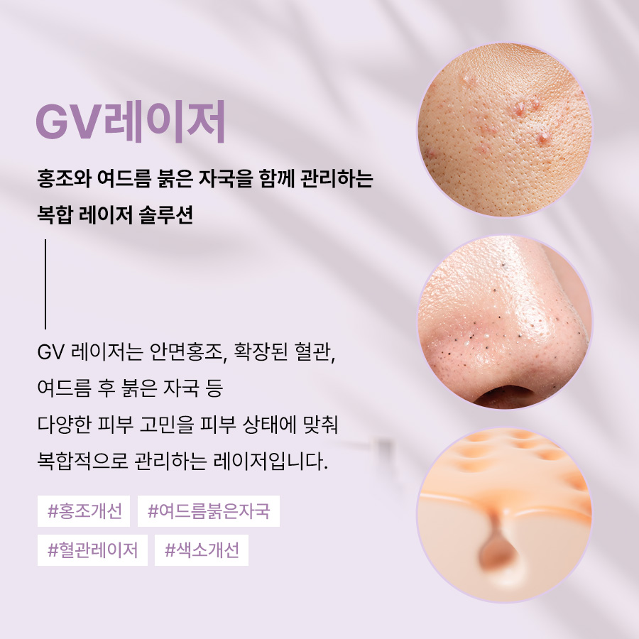 본문 내용을 보조하는 이미지